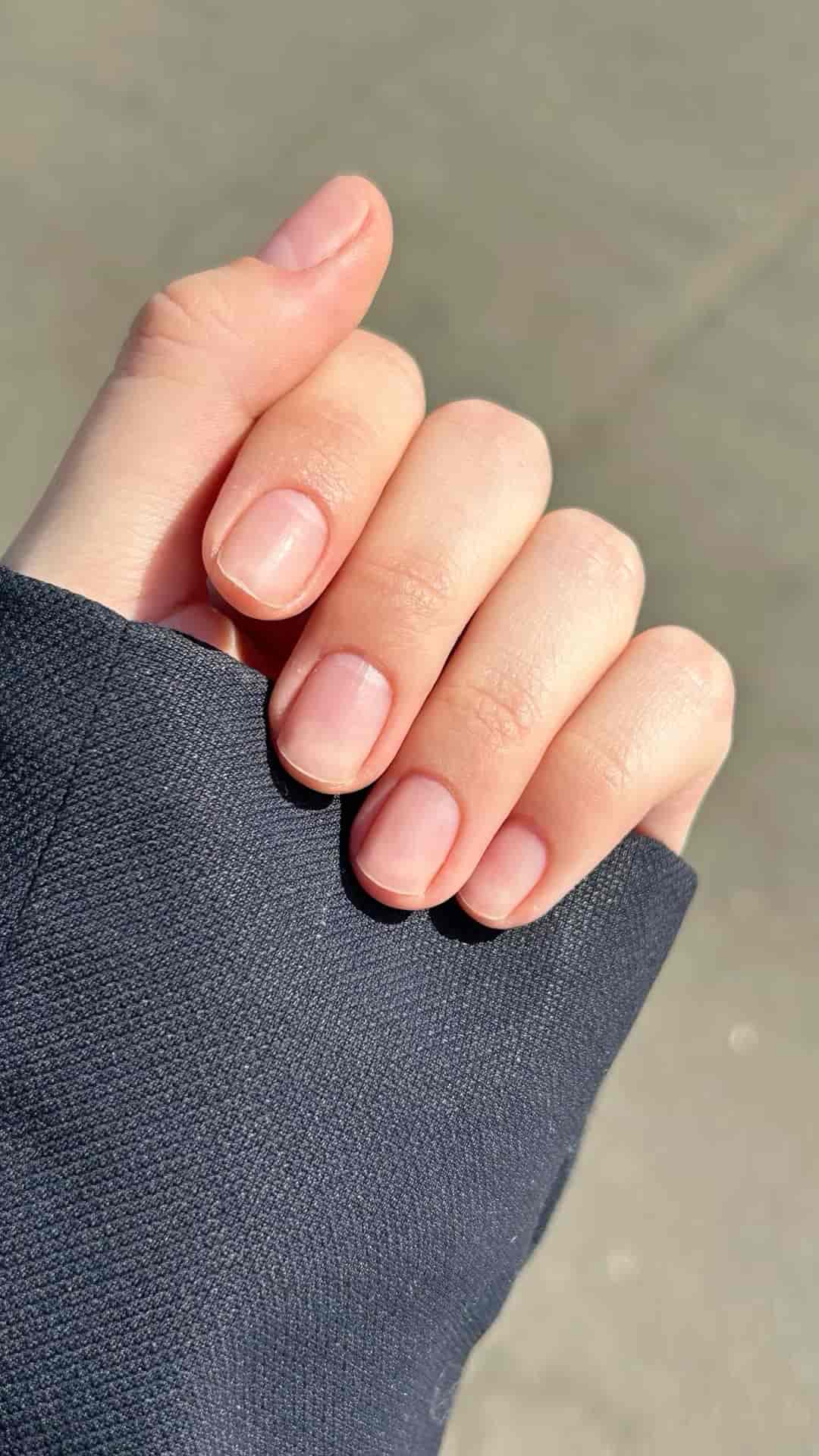 Phục hồi móng